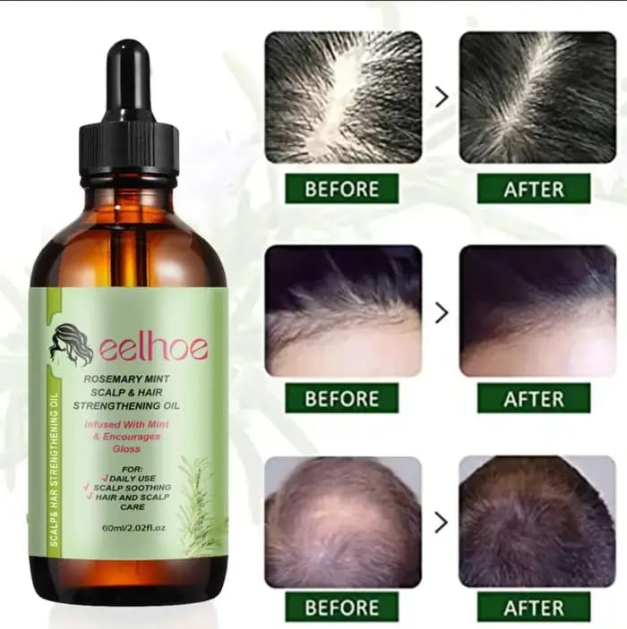 Huile essentielle de croissance des cheveux, soin nourrissant, traitement pour les extrémités et les cheveux secs